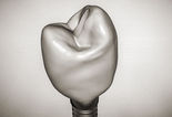 Cerec