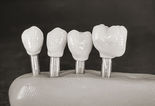 Cerec